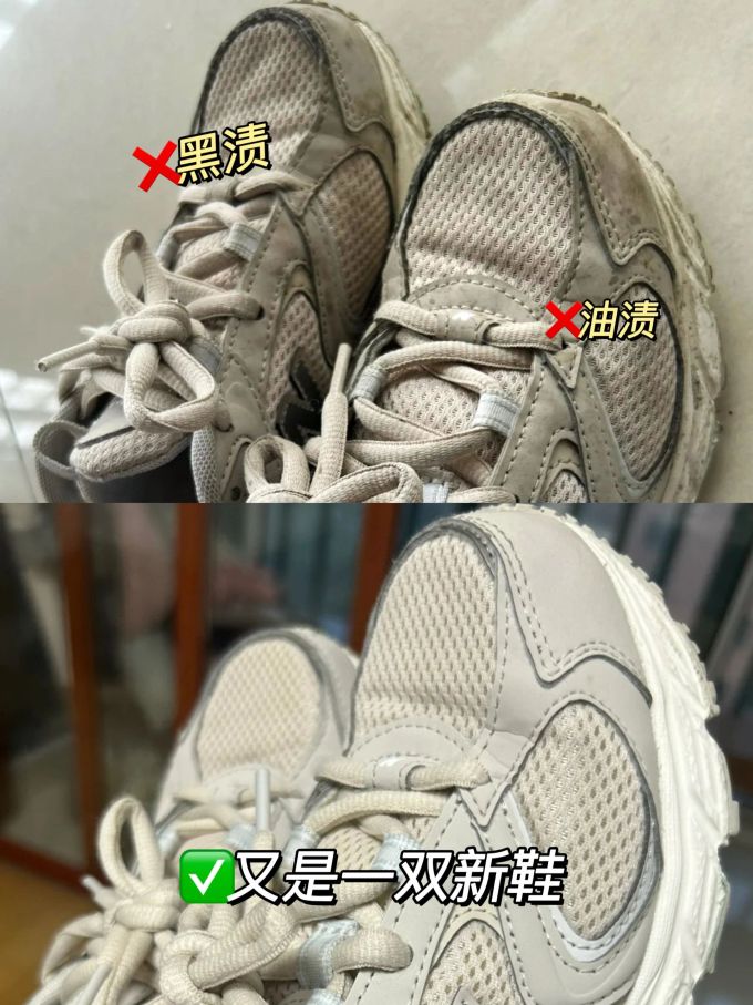系带 